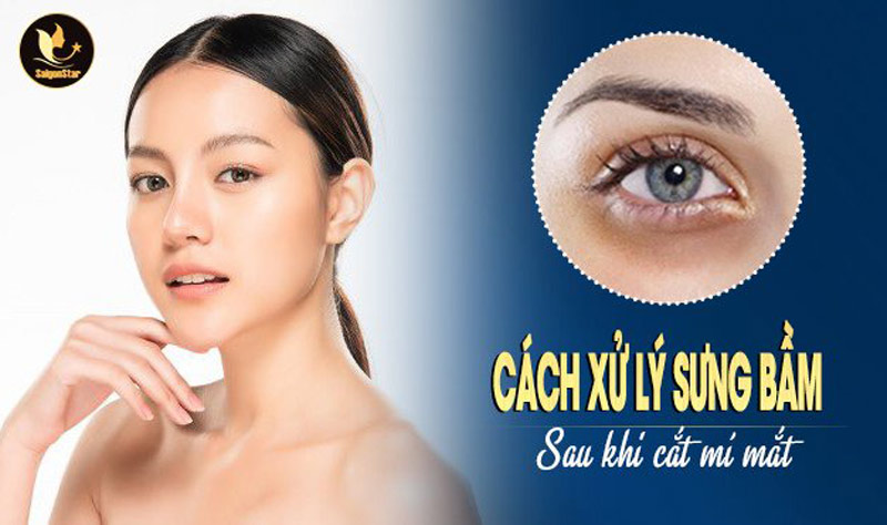 Ăn Gì Để Giảm Sưng Sau Cắt Mí: Hướng Dẫn Chi Tiết Để Đạt Hiệu Quả Tốt Nhất